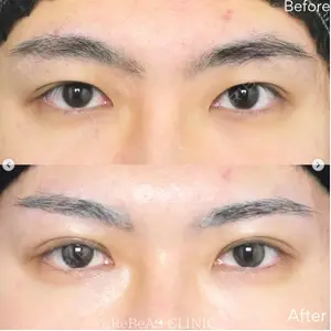 ReBeAS CLINICの症例