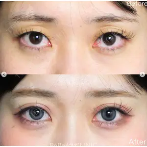 ReBeAS CLINICの症例