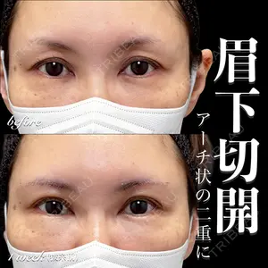 EMMO FACE CLINIC 大宮院 百瀬 直也医師の症例