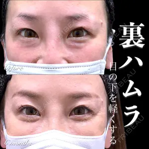 EMMO FACE CLINIC 大宮院 百瀬 直也医師の症例