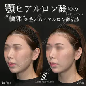 Zetith Beauty Clinic 大阪心斎橋院 楠本 拓哉医師の症例