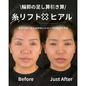 Zetith Beauty Clinic 銀座院 橘　澄医師の症例