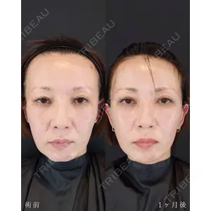 HAAB BEAUTY CLINIC 南青山本院（新院） 小平 佳典医師の症例