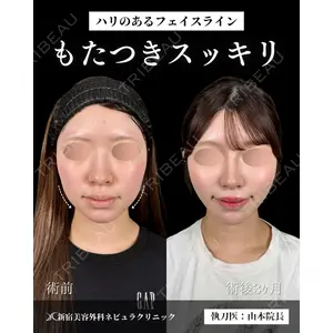 新宿美容外科ネビュラクリニック 山本 紘子医師の症例