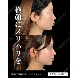 新宿美容外科ネビュラクリニック 山本 紘子医師の症例