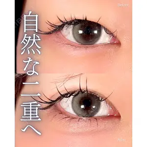 神戸美容外科 ネビュラクリニック 岩﨑 雅医師の症例