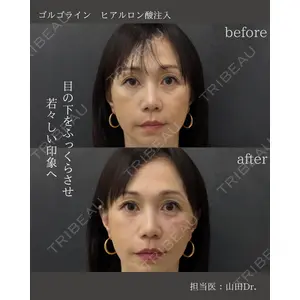 銀座美容外科クリニック 銀座院 山田 理史医師の症例