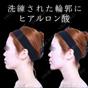 アリエル美容クリニック 水戸院 天白 典秀医師の症例