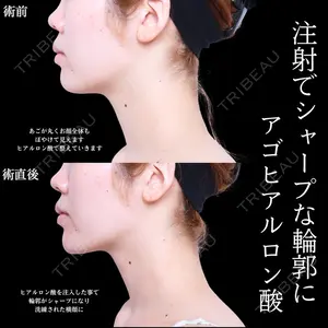 アリエル美容クリニック 水戸院 天白 典秀医師の症例