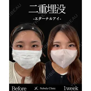 ネビュラクリニック 東京錦糸町院 岩切 琢磨医師の症例