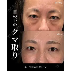 愛知春日井美容外科ネビュラクリニック 都築 諒医師の症例