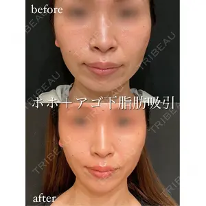 アデル美容クリニックの症例
