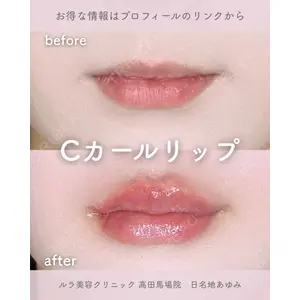 ルラ美容クリニック 高田馬場院 日名地 あゆみ医師の症例
