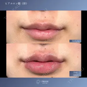 PRISM Beauty Clinic 町田院 森本 理一郎医師の症例