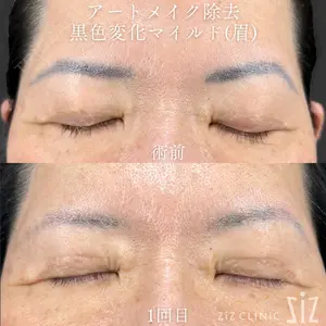 ziz CLINIC 村岡 史子医師の症例