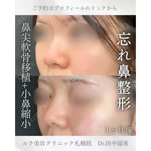 ルラ美容クリニック 札幌本院 田中 瑞希医師の症例