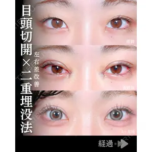 東京シンデレラ美容外科 池袋院 石井 達也医師の症例