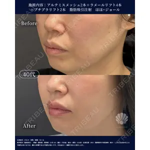 LA MER CLINIC 辻 航平医師の症例
