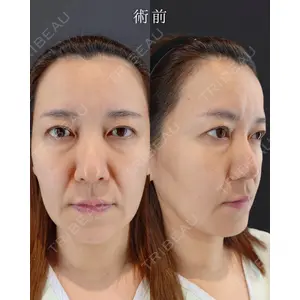 HAAB BEAUTY CLINIC 南青山本院（新院） 小平 佳典医師の症例