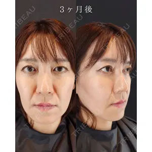 HAAB BEAUTY CLINIC 南青山本院（新院） 小平 佳典医師の症例