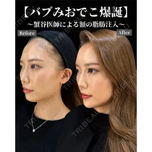 HAAB BEAUTY CLINIC 南青山本院（新院） 蟹谷 莉麻医師の症例