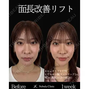 ネビュラクリニック 東京錦糸町院 岩切 琢磨医師の症例