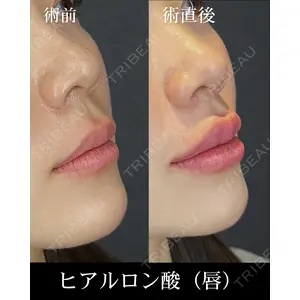 HAAB CLINIC 横浜院 圓田 倫永医師の症例