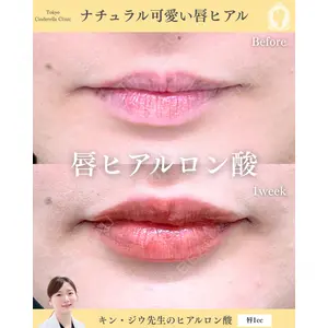 東京シンデレラ美容外科 新宿院 金智優医師の症例
