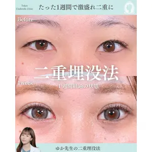 東京シンデレラ美容外科 新宿院 宮﨑友伽医師の症例