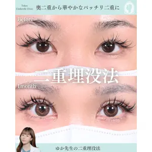 東京シンデレラ美容外科 新宿院 宮﨑友伽医師の症例