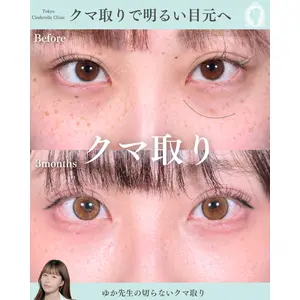 東京シンデレラ美容外科 新宿院 宮﨑友伽医師の症例