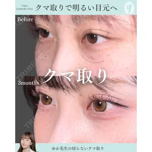 東京シンデレラ美容外科 新宿院 宮﨑友伽医師の症例