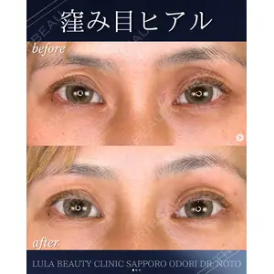 ルラ美容クリニック 札幌大通り院 能登 貴弘医師の症例