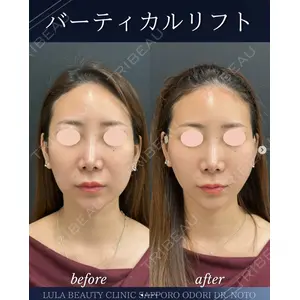 ルラ美容クリニック 札幌大通り院 能登 貴弘医師の症例