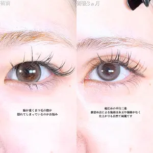 アリエル美容クリニック 大宮院 鈴木　桂介医師の症例