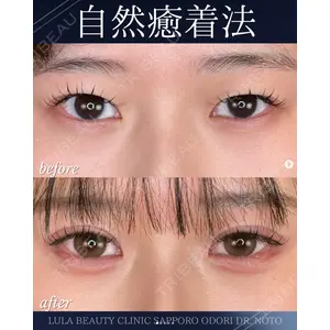 ルラ美容クリニック 札幌大通り院 能登 貴弘医師の症例