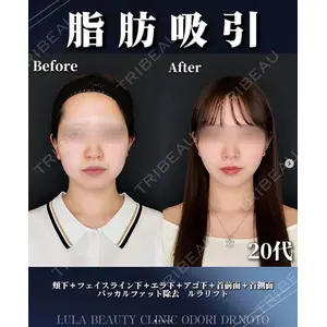 ルラ美容クリニック 札幌大通り院 能登 貴弘医師の症例