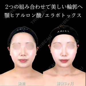 アリエル美容クリニック 横浜院 渡邉 光医師の症例