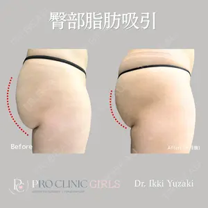 PRO CLINIC プロクリニック 銀座院 柚﨑 一輝医師の症例