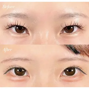 R Beauty CLINIC 名古屋院 木村 尚大医師の症例