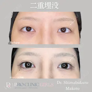 PRO CLINIC プロクリニック 銀座院 島袋 真人医師の症例