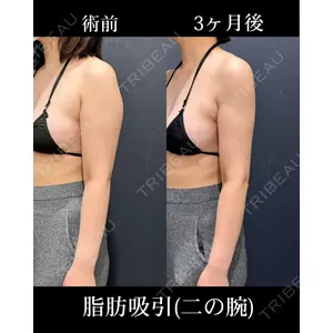 HAAB×DREAM BEAUTY CLINIC 東京本院 吉岡 修一医師の症例