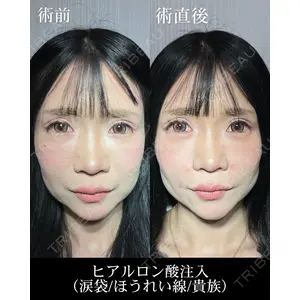 HAAB CLINIC 福岡院 北村 可恋医師の症例