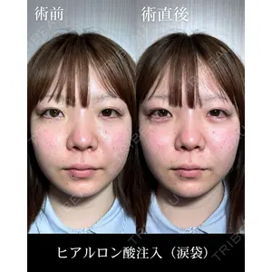 HAAB CLINIC 福岡院 北村 可恋医師の症例