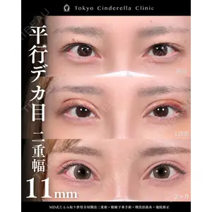 東京シンデレラ美容外科 新宿院 吉原 伯医師の症例