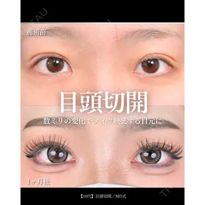 東京シンデレラ美容外科 大宮院 竹田 昌平医師の症例