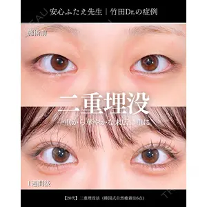 東京シンデレラ美容外科 大宮院 竹田 昌平医師の症例