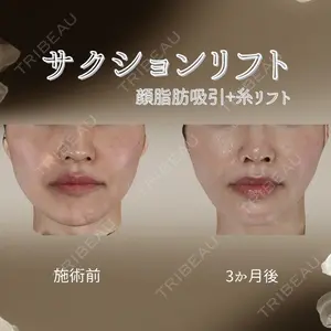 下北沢スキンクリニックの症例