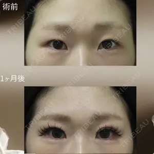 下北沢スキンクリニックの症例