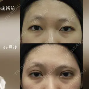 下北沢スキンクリニックの症例